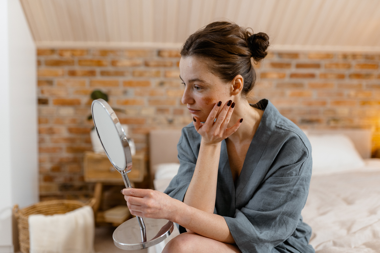 The Complete Guide to Managing Rosacea